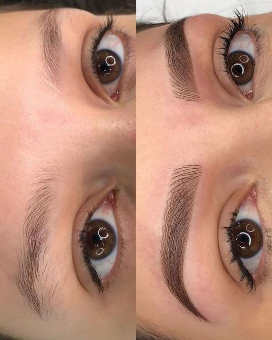 Antes e depois de design de sobrancelhas — cliente 3